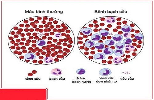 Chớ xem thường cơn ớn lạnh đột ngột